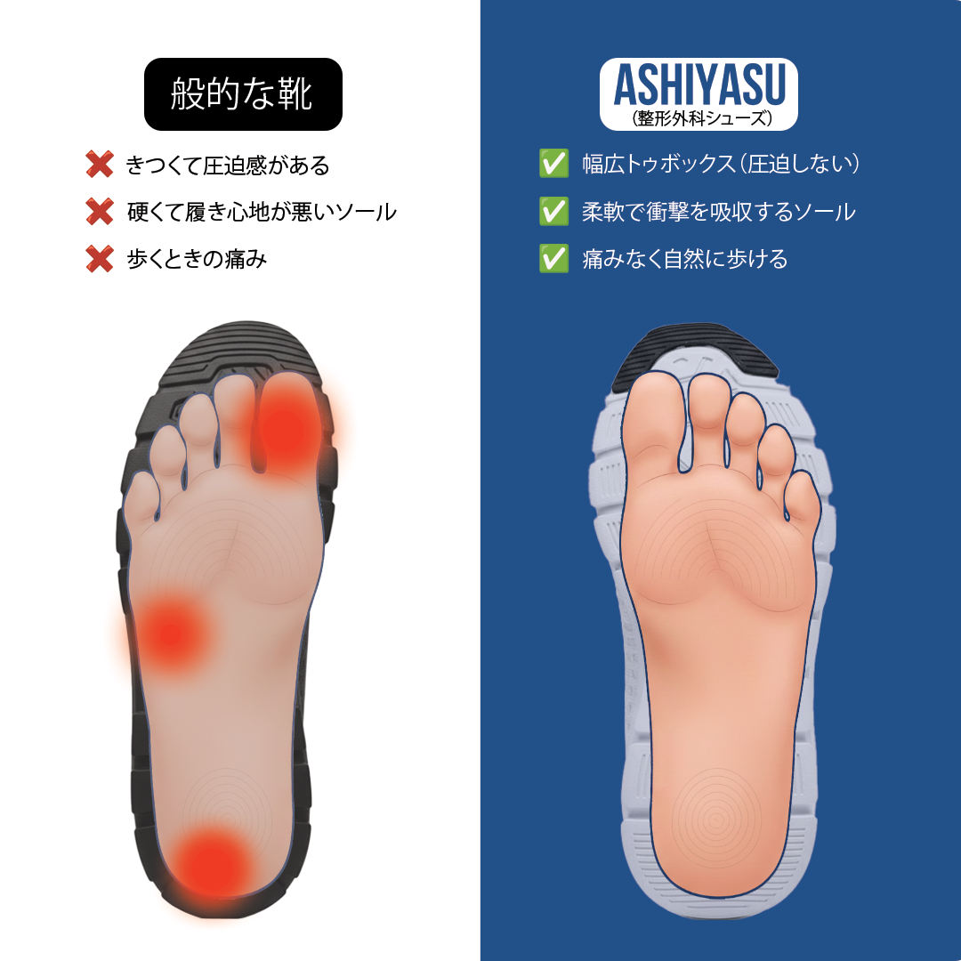 ASHIYASU フットサポートPro – 一歩目から足裏が軽く感じる（ユニセックス）